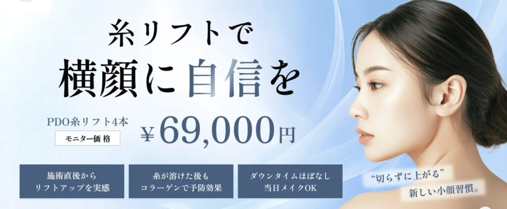 糸リフト(小顔)