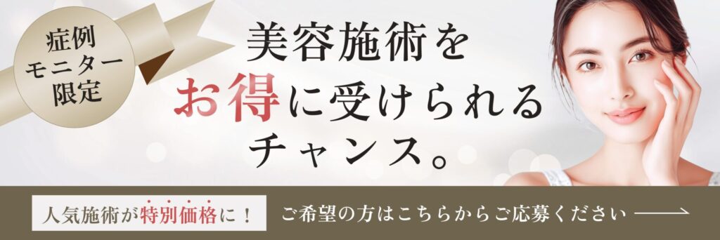 モニター募集