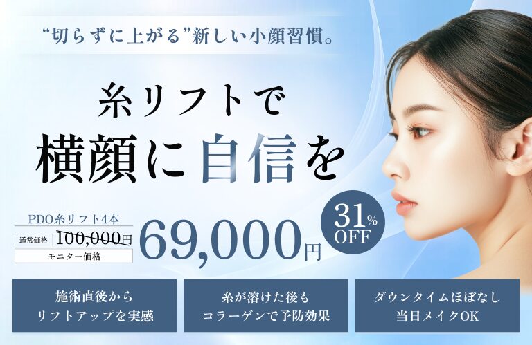 糸リフト