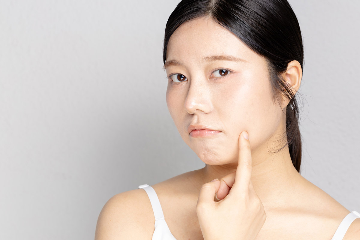 糸リフトの術後にボコボコするのは失敗？馴染むまでの期間と対処法