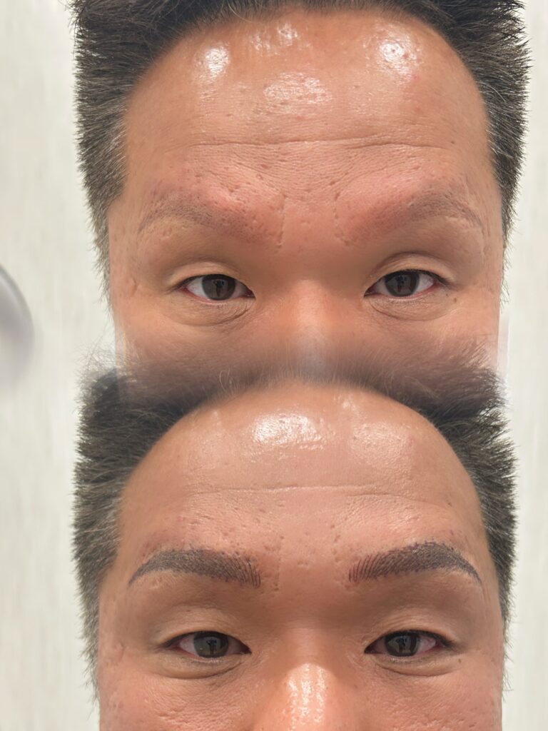 アートメイク