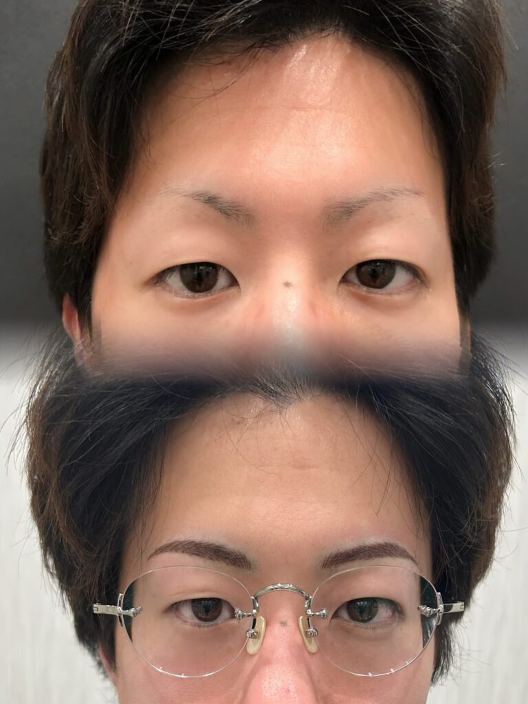アートメイク