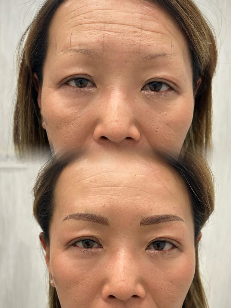 アートメイク